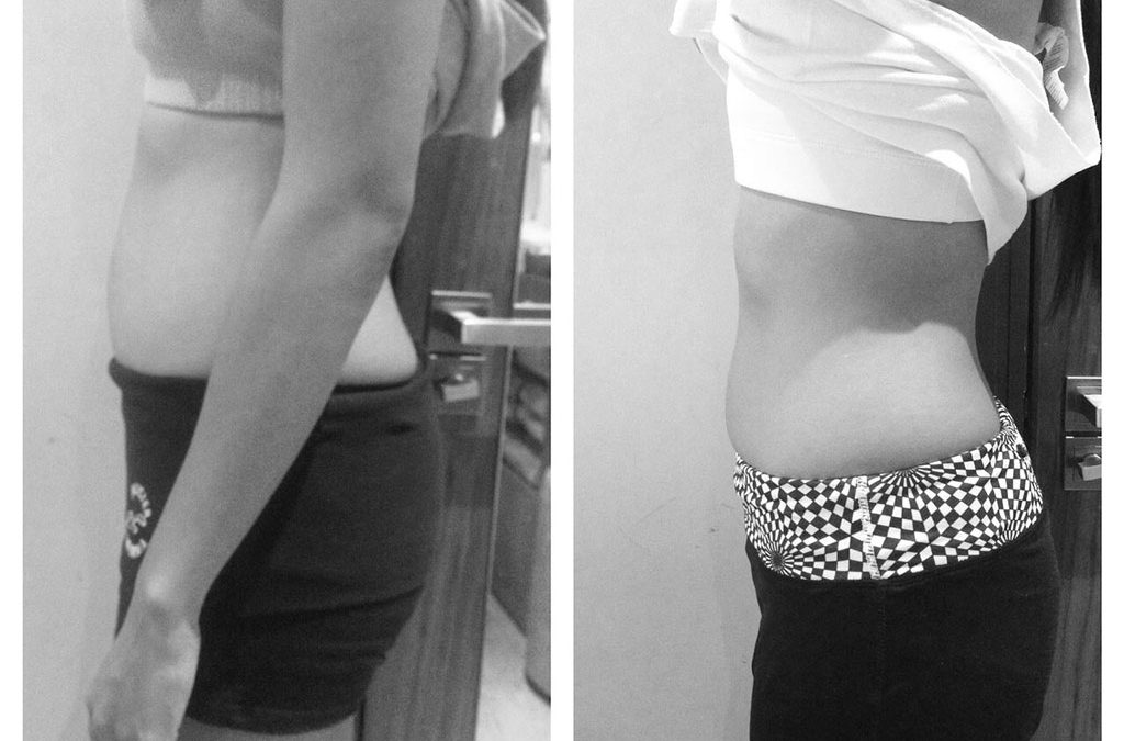 Success Stories – Chloe